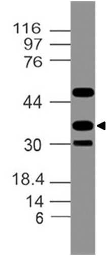 CDX2 Antibody