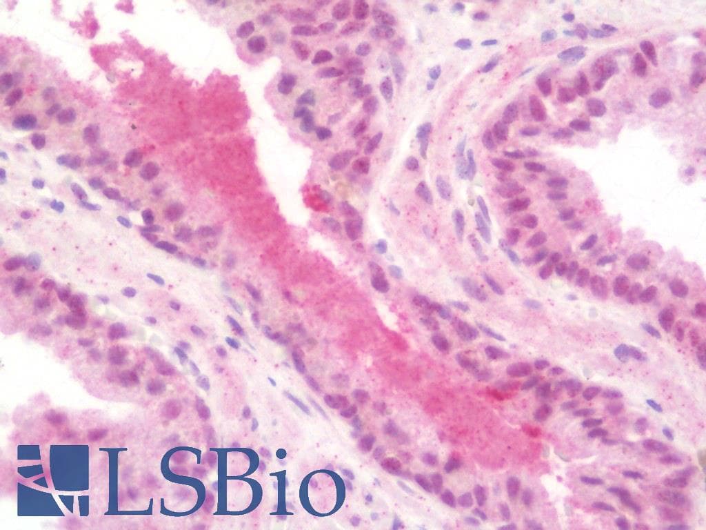 IHC-plus™ Polyclonal Rabbit anti-Human KDM1B Antibody (IHC, WB)