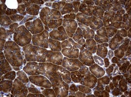 NME1 / NM23 Antibody (clone OTI2A5)