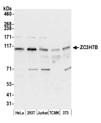 ZC3H7B Antibody (aa250-300)