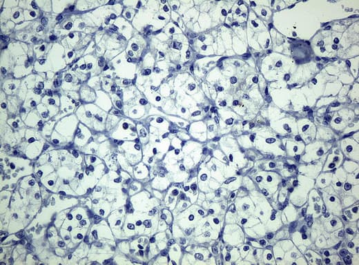 KRT19 / CK19 / Cytokeratin 19 Antibody (aa240-390, clone UMAB3, Carrier-free)