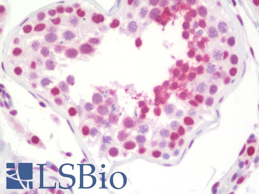 IHC-plus™ CENPU / MLF1IP Antibody