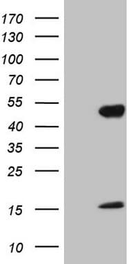 NR2E3 / PNR Antibody (clone OTI2G3)