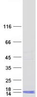 Human ACRV1/Intra-Acrosomal Protein (Recombinant Myc-DDK (Flag))