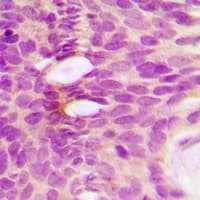 ALAD Antibody