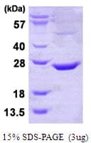 Human CTDSPL Protein (Recombinant His)