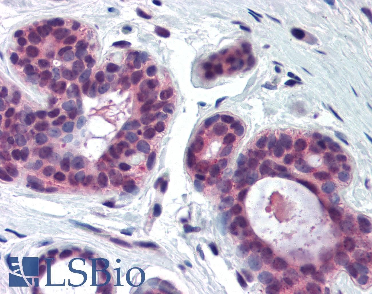 IHC-plus™ Polyclonal Rabbit anti-Human CDK2 Antibody (C-Terminus, IHC, IF, WB)