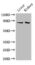 Polyclonal Rabbit anti-Human SMO / Smoothened Antibody (IHC, IF, WB)