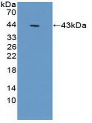 ACTG1 / Gamma Actin Antibody (aa1-375)
