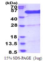 Human BCCIP Protein (Recombinant His)
