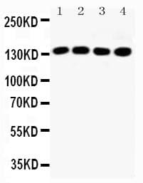 IRS1 Antibody (aa106-122)