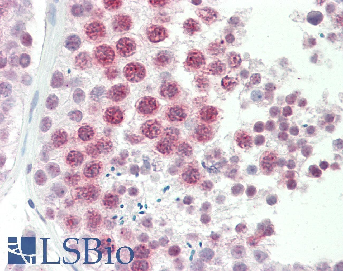 IHC-plus™ Polyclonal Goat anti-Human DNAJC5G Antibody (aa157-170, IHC)