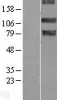 NEK9 Protein (Over-Expression Lysate Myc-DDK (Flag))