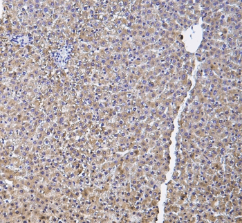 HP / Haptoglobin Antibody