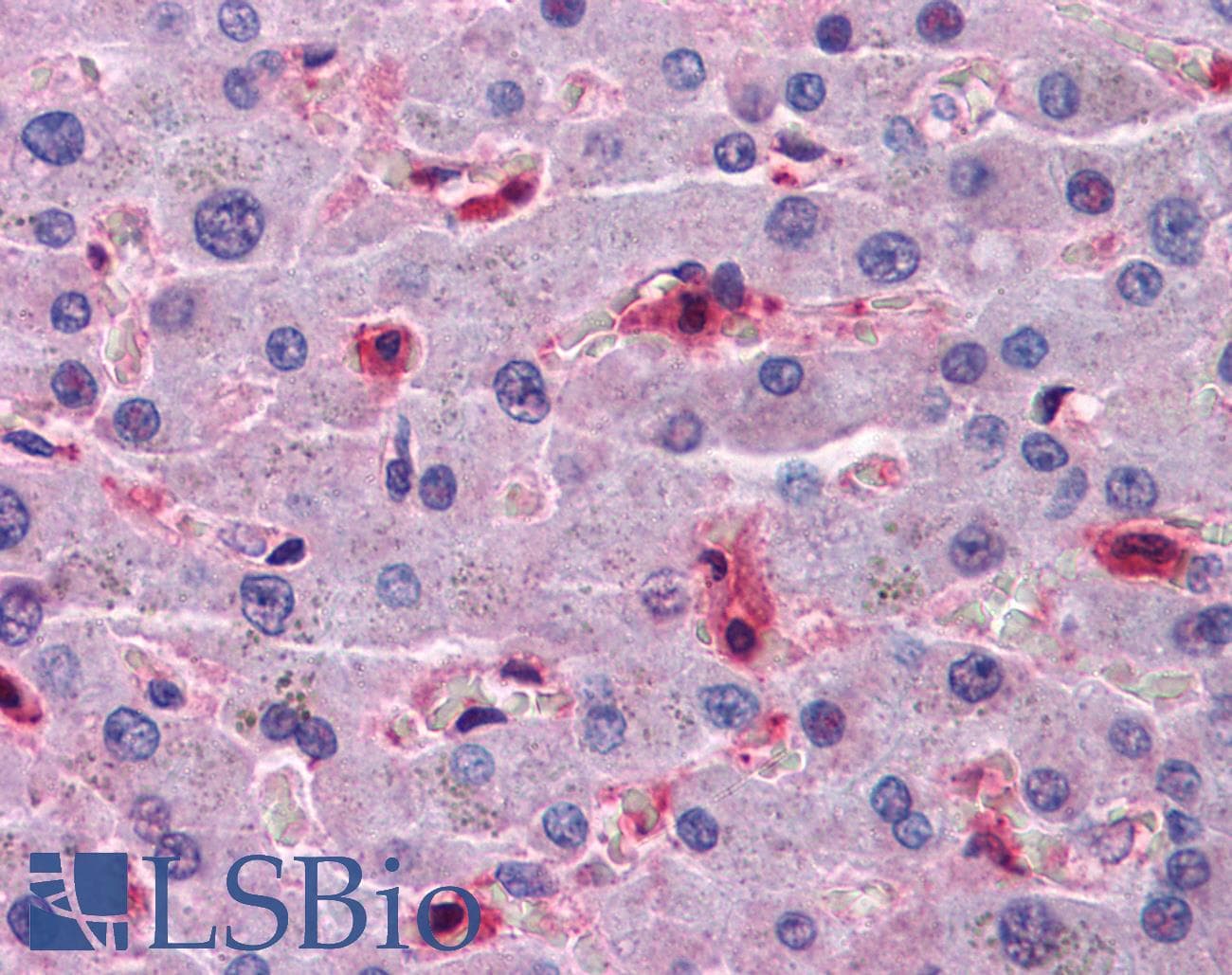IHC-plus™ Monoclonal Mouse anti-Human HAMP / Hepcidin Antibody (clone 1F9, IHC, WB)