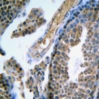 Polyclonal Rabbit anti-Human FSH Receptor / FSHR Antibody (Internal, IHC, WB)