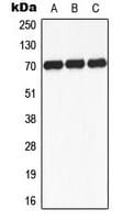 Polyclonal Rabbit anti-Human RPS6KB1 / P70S6K / S6K Antibody (phospho-Ser434, IHC, IF, WB)