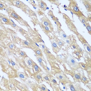Polyclonal Rabbit anti-Human PPP4R1 / PP4R1 Antibody (IHC, WB)