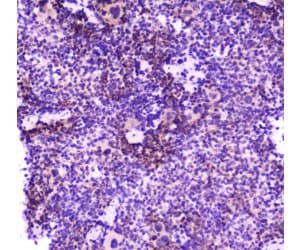 PLCG2 / PLC Gamma 2 Antibody