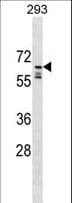 Polyclonal Rabbit anti-Human PPIL2 / CYP60 Antibody (aa402-431, WB)