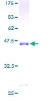 Human PPP3R1 / Calcineurin B Protein (Recombinant GST)
