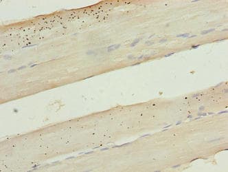 KRT80 / Keratin 80 Antibody