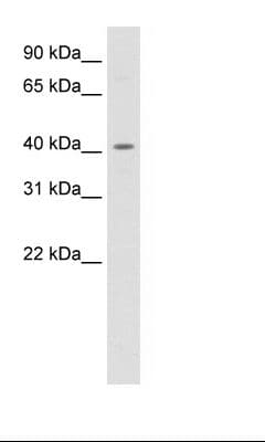 PPARD / PPAR Delta Antibody (C-Terminus)