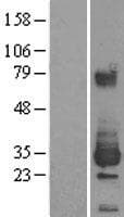 ETHE1 Protein (Over-Expression Lysate Myc-DDK (Flag))