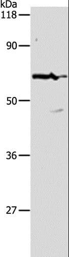 PKM / Pyruvate Kinase, Muscle Antibody