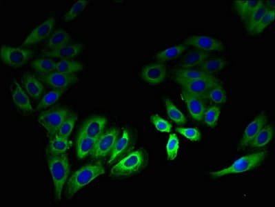 LSMEM2 / C3orf45 Antibody