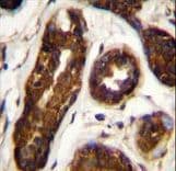 SERPINB5 / Maspin Antibody (aa94-123)