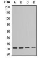 Esterase D / ESD Antibody