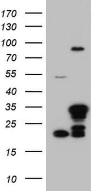 LGALS3 / Galectin 3 Antibody (clone OTI6E1)