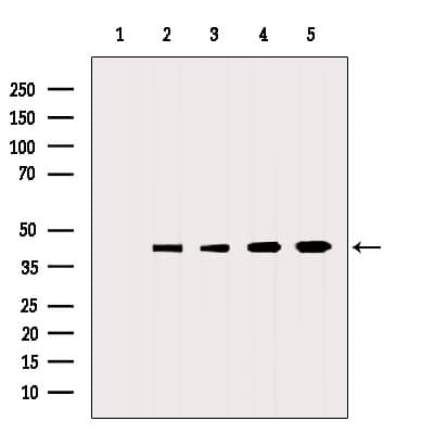 Polyclonal Rabbit anti-Human NRN1 / Neuritin Antibody (WB)