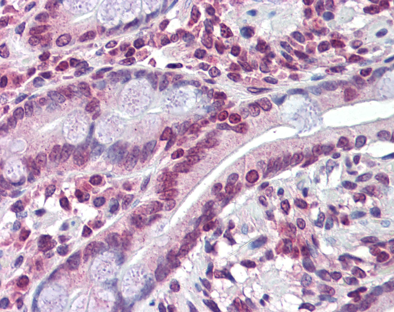 ABCC8 / SUR1 Antibody (N-Terminus)