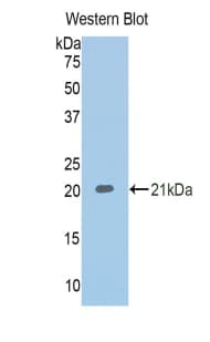 SERPINA6 / CBG Antibody (aa218-378)