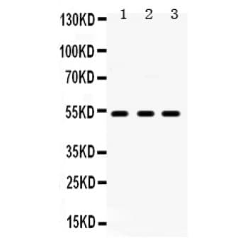 HTR2A / 5-HT2A Receptor Antibody (aa400-431)