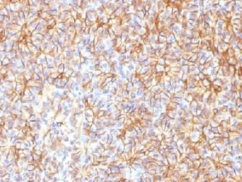 SPTBN2 Antibody (clone SPTBN2/1584, Azide-free, BSA-free)