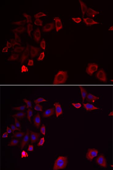 SKAP2 / SCAP2 Antibody