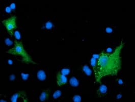 ARFGAP1 Antibody (clone OTI2C6)