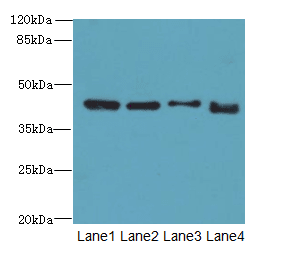Polyclonal Rabbit anti-Human DDI2 Antibody (IHC, WB)