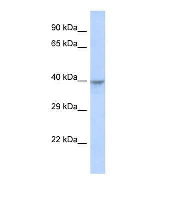 DACH2 Antibody (C-Terminus)