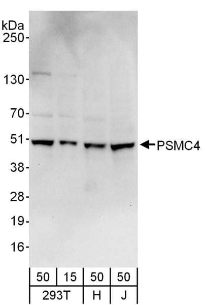 Polyclonal Rabbit anti-Human PSMC4 Antibody (aa1-50, IHC, WB)