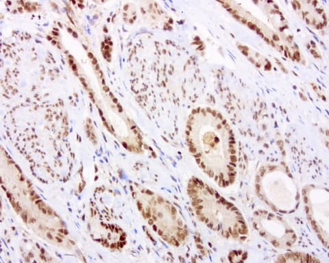 C14orf166 Antibody (clone UMAB182)