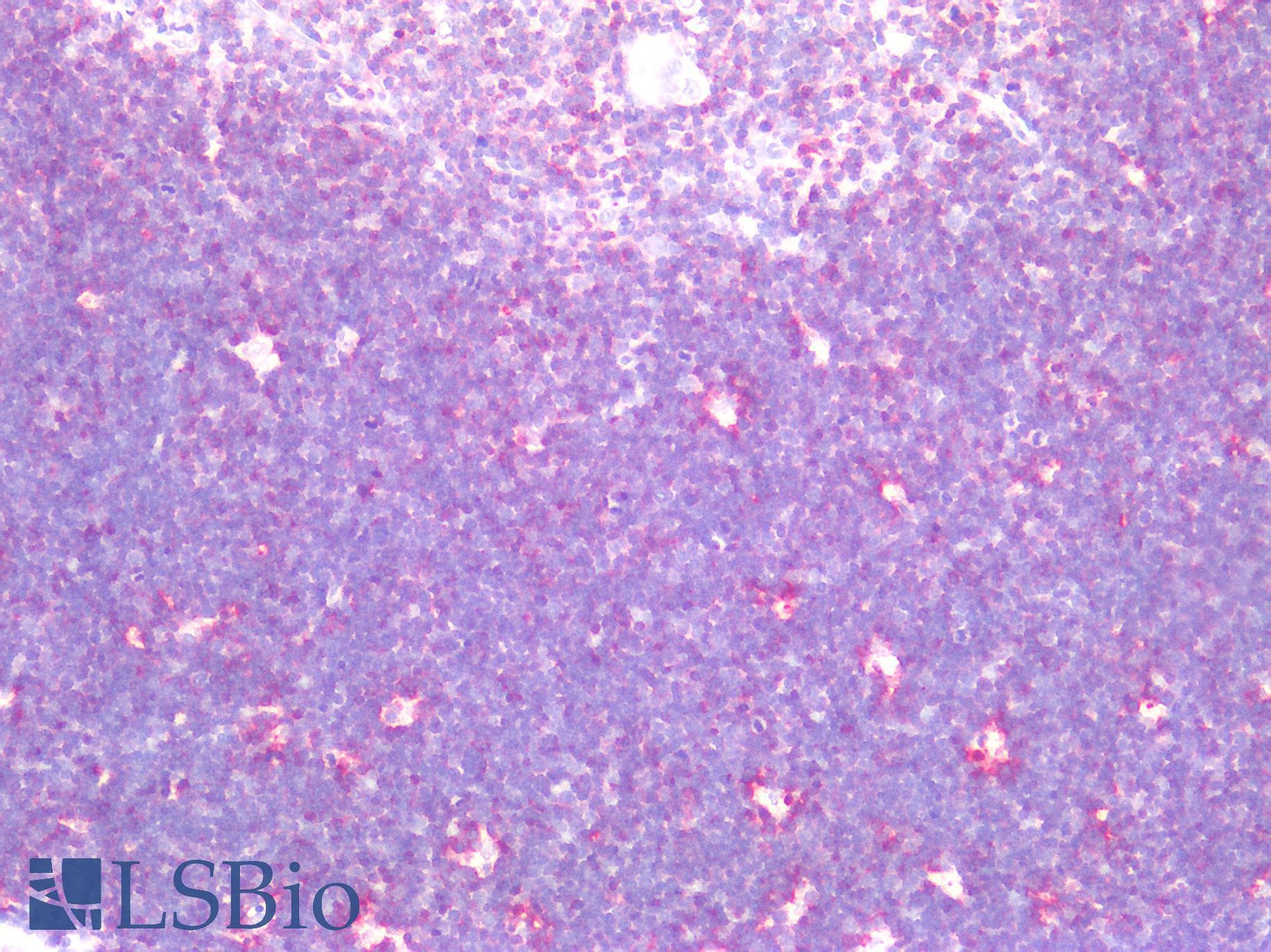 PathPlus™ CD38 Antibody (C-Terminus)
