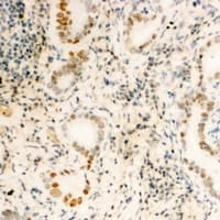 Polyclonal Rabbit anti-Human FUBP3 Antibody (Internal, IHC, WB)