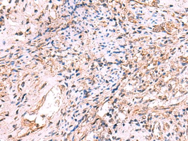 Polyclonal Rabbit anti-Human OSBPL2 Antibody (IHC)