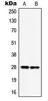 HOXB9 Antibody (C-Terminus)