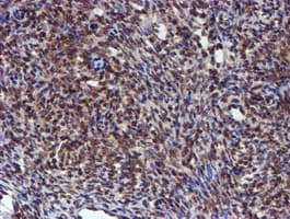 HARS2 Antibody (clone OTI5H2)