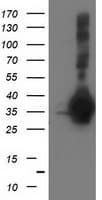 SIRT5 / Sirtuin 5 Antibody (clone OTI 1G9)